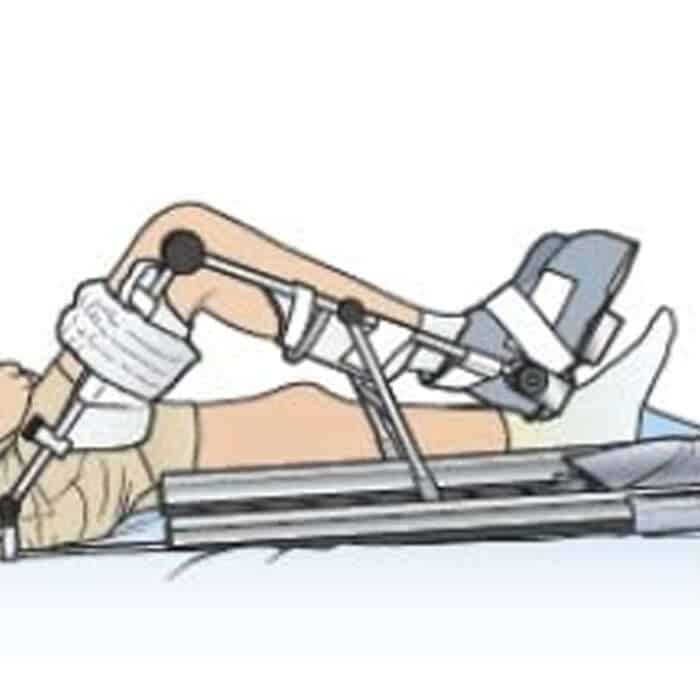 Knee Exercise CPM Machine Rental in Ann Arbor